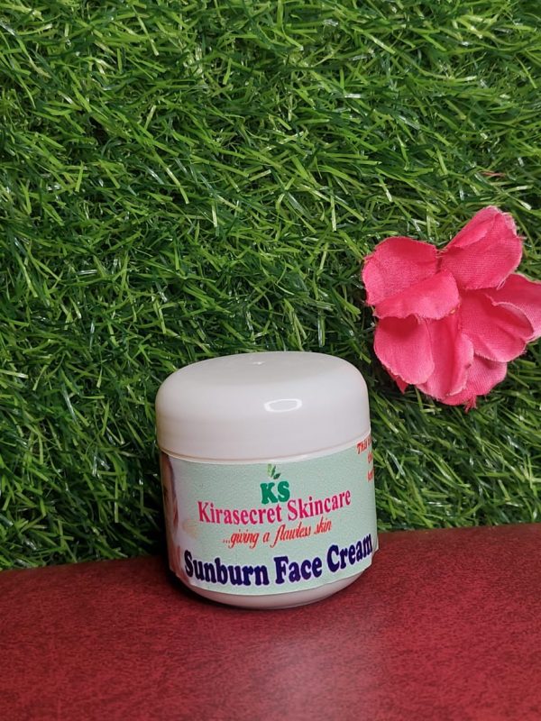 sun burn remover face cream