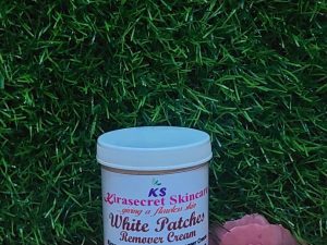 white patch remover cream