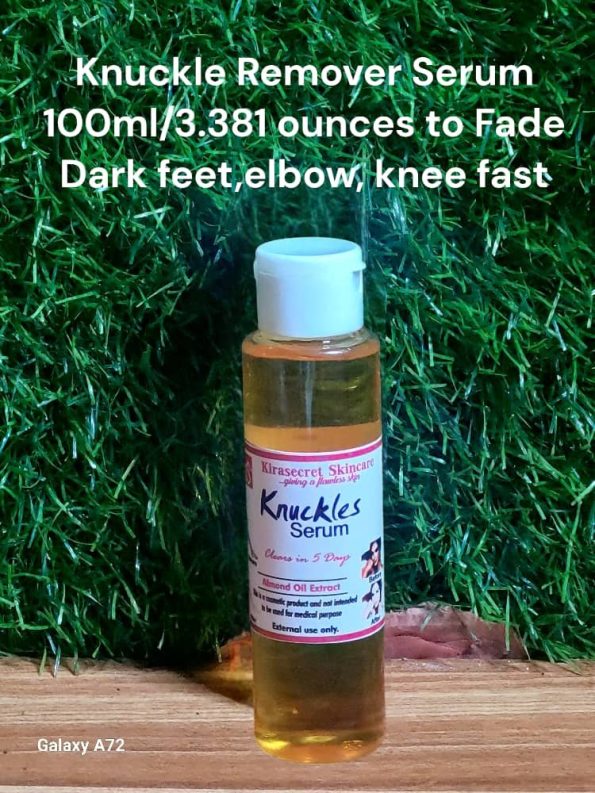 KNUCKLE REMOVER SERUM QUICK RESULT to Fade Dark knuckle Feet ,hands, Elbows very fast 100ml