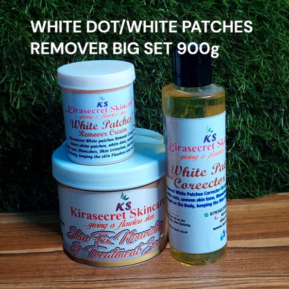 WHITE DOT WHITE PATCHES Big SET QUICK RESULT 900G It Clears Old White dots and Patchhes Very Fast out of your Skin