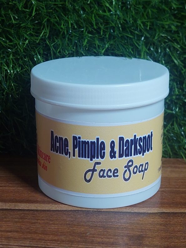 ACNE PIMPLES AND DARKSPOT REMOVER FACE SOAP 400G It Clear the Face Very Fast Super Effective